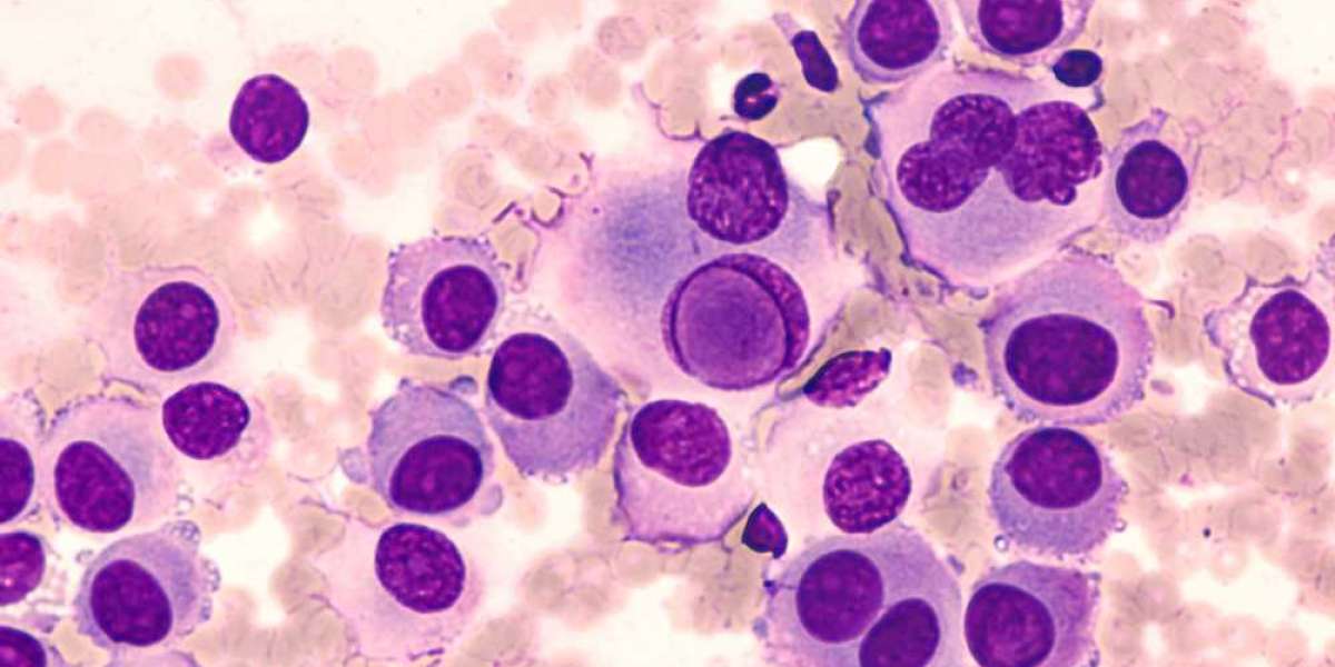 Patient-Centric Approaches in the Metastatic Melanoma Drug Market