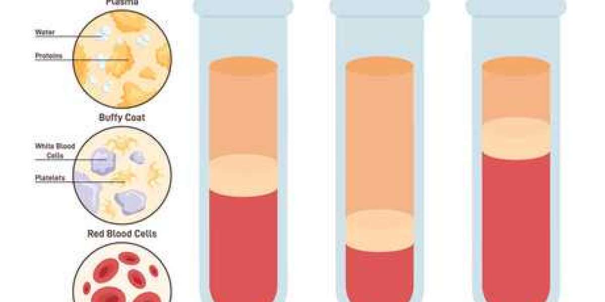 Emerging Trends in the Bovine Blood Plasma Derivatives Market: A Comprehensive Overview